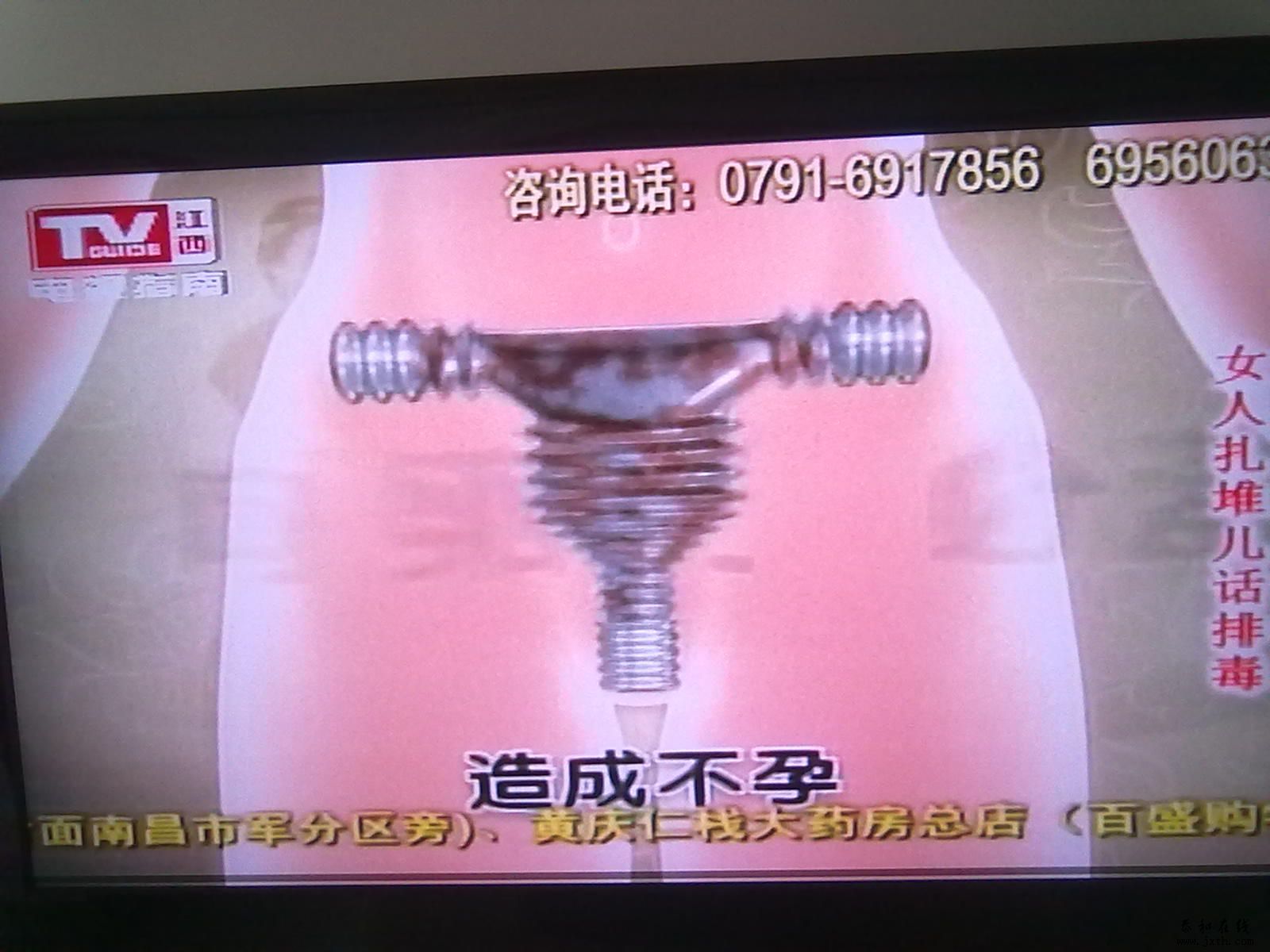 20110529320.jpg